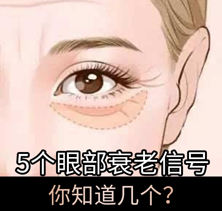 5个眼部衰老信号，你知道几个？