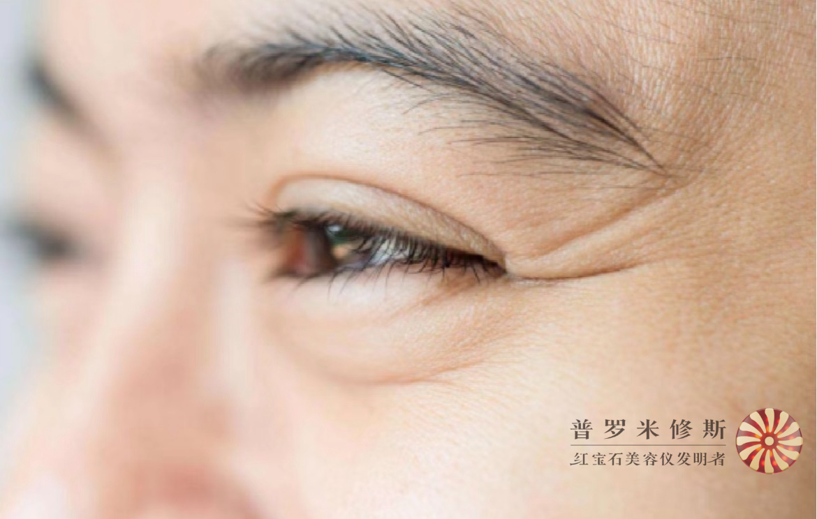 烙铁们，你的鱼尾纹真的需要熨一下！